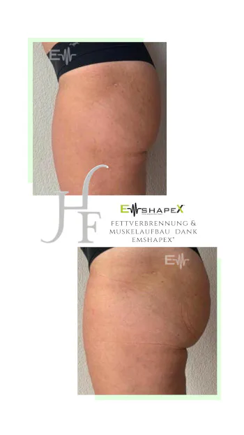 Sanabelle Laserzentrum Winterthur